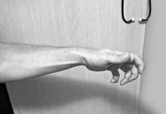 Травма руки Ф. А. Субботина Травма руки Ф. А. Субботина
