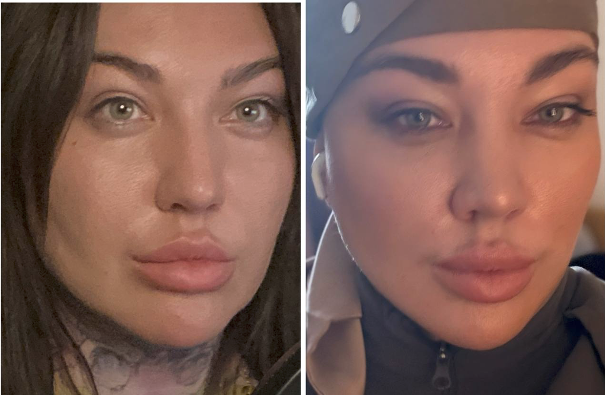 <p>
		Мои 39 и 43, об уходе и пластике я знаю всё, ну или почти всё.</p> <p>
		Мои 39 и 43, об уходе и пластике я знаю всё, ну или почти всё.</p>