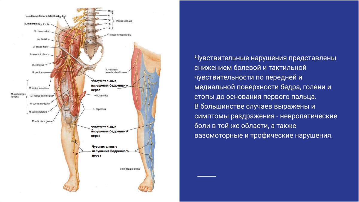 Чувствительные нарушения при поражение бедренного нерва Чувствительные нарушения при поражение бедренного нерва