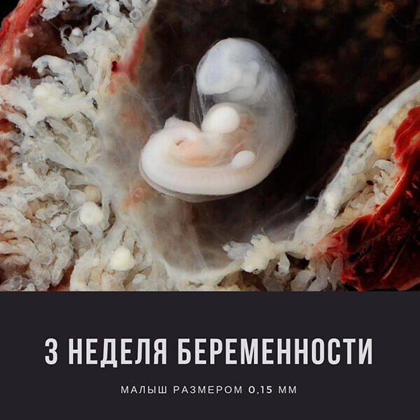 3 неделя беременности 3 неделя беременности