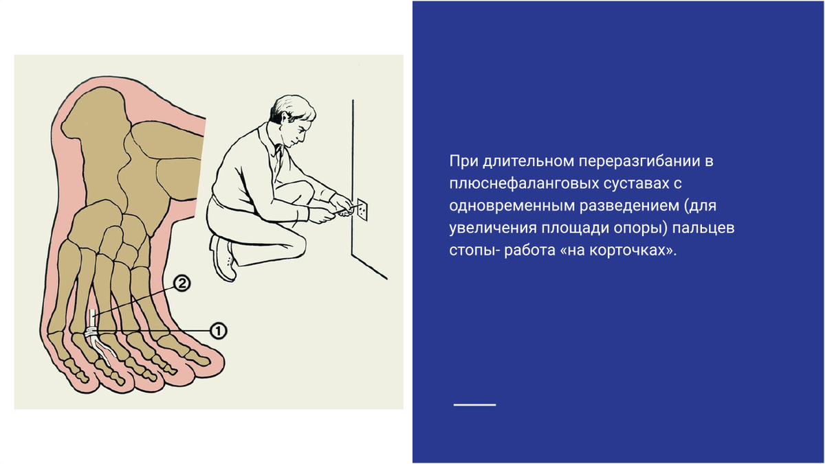Переразгибание пальцев стопы Переразгибание пальцев стопы
