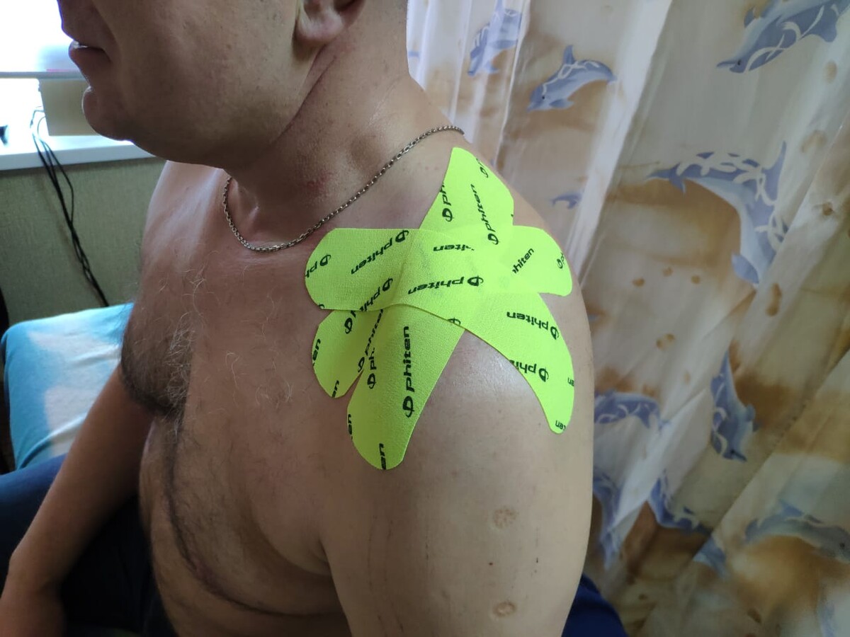 Тейпирование при повреждении акромиально-ключичного сочленения Тейпирование при повреждении акромиально-ключичного сочленения
