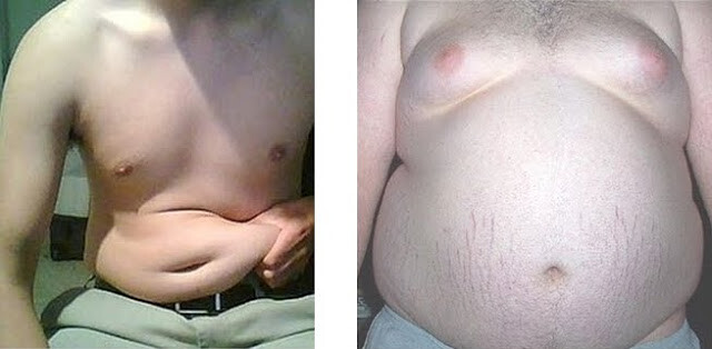 Подкожный жир слева, висцеральный - справа