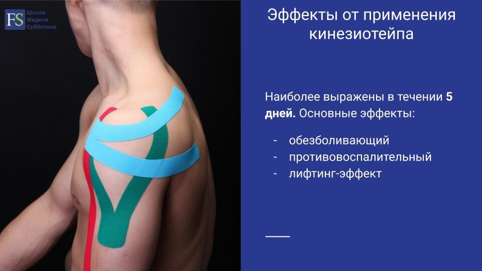 Тейпирование рубца от кс схема