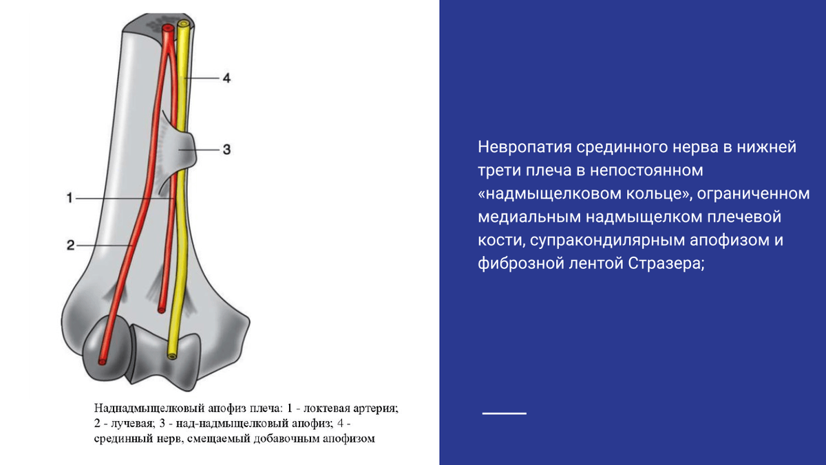 Приора маленькая компрессия