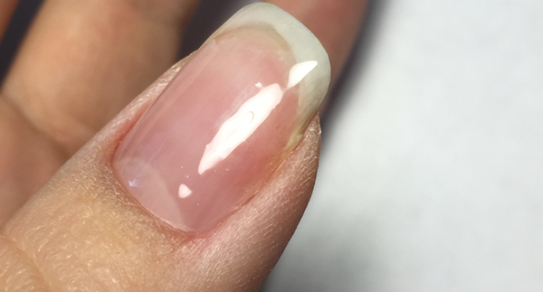 Ремонт трещины натурального ногтя. Записи блога