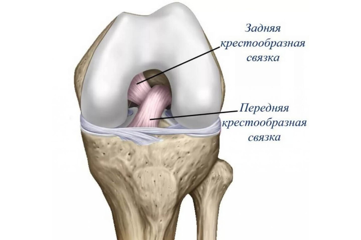 Колено разрыв связок операция