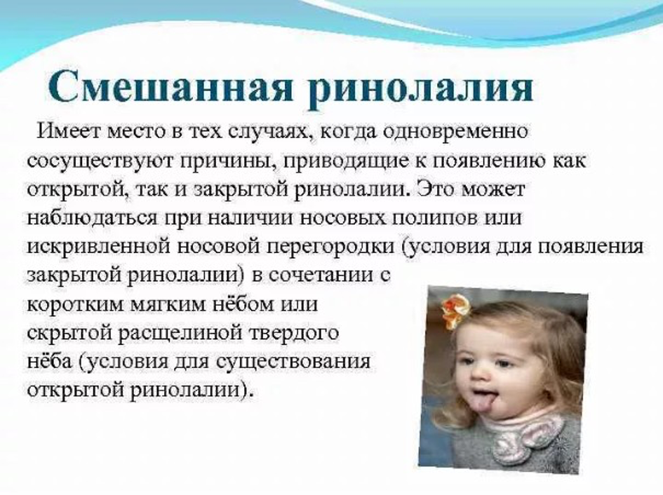 Смешанная ринолалия это в логопедии. Ринолалия в логопедии проявление. Открытая ринолалия это в логопедии. Причины возникновения ринолалии.