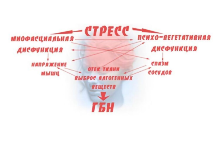 Как лечить стрессовую. Головная боль напряжения. Головная юоль напряжения. Головная боль мышечного напряжения. Головная боль напряжения причины.