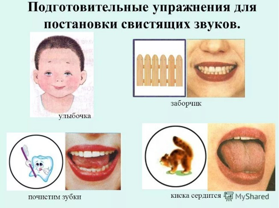 Коррекция шипящих. Упражнения для постановки свистящих звуков. Упражнения для звука с артикуляционная гимнастика. Артикуляционная гимнастика для дошкольников свистящие. Гимнастика для свистящих звуков.