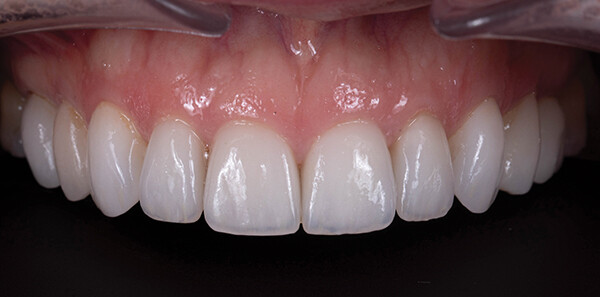 
		
		
		<p>
		Рис. 14</p>			