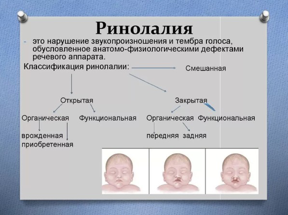 Нарушение голоса при ринолалии