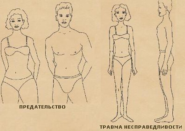 Пять травм картинки