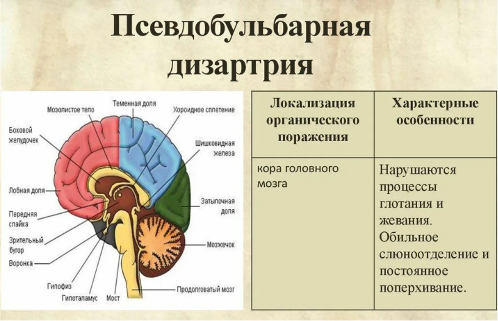 Речевая карта дизартрия