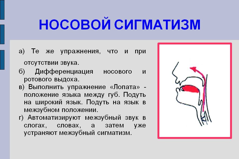 Формирование звука произношения. Губно-зубной сигматизм шипящих звуков. Межзубный сигматизм артикуляционный профиль звука. Межзубный парасигматизм свистящих. Причины межзубного сигматизма свистящих.