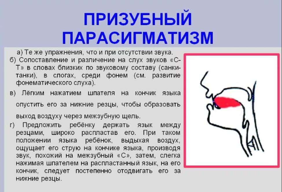 Сигматизм: причины, виды и методы коррекции | Дефектология Проф