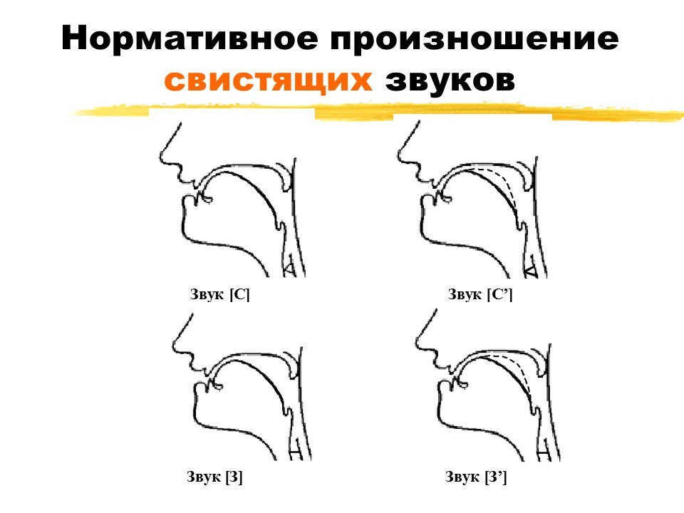 Носовой сигматизм свистящих. Артикуляция свистящих звуков. Сигматизм свистящих звуков. Профили артикуляции свистящих звуков.