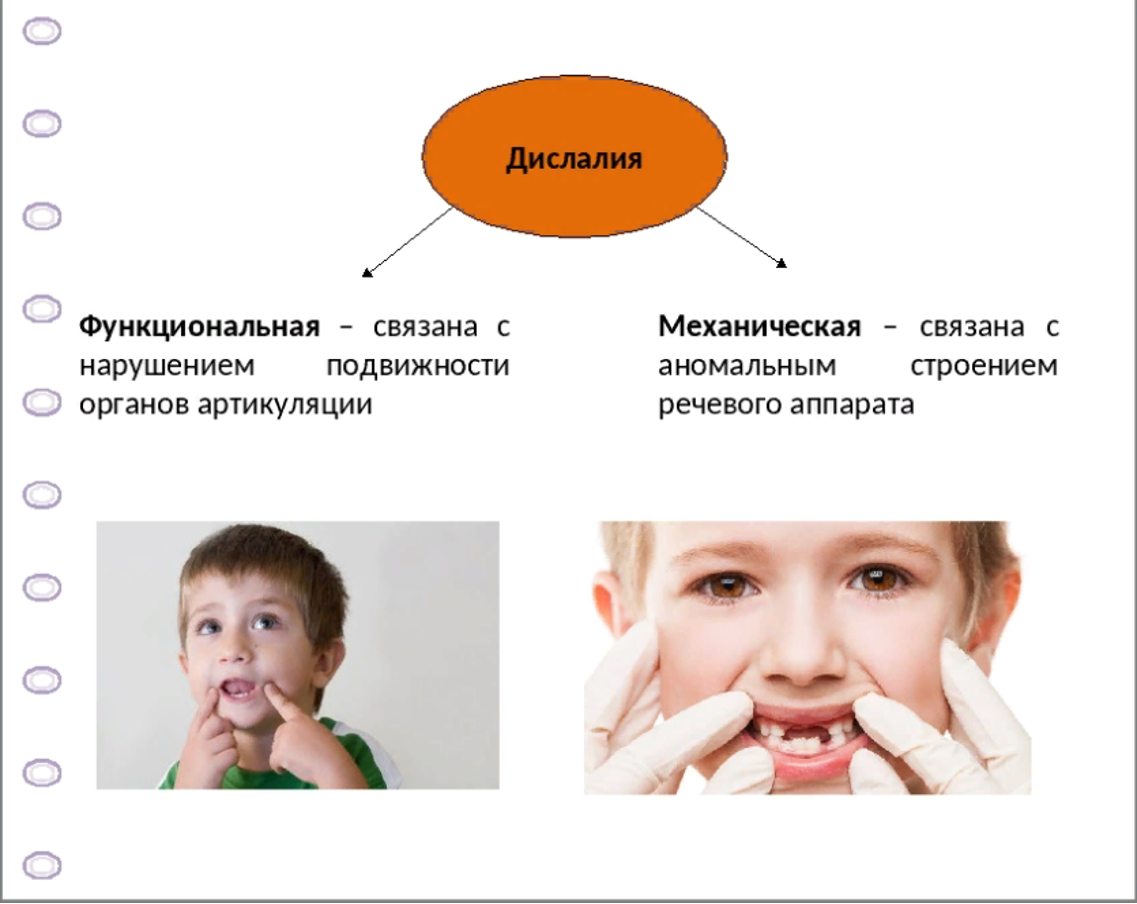 Дислалия картинки для презентации