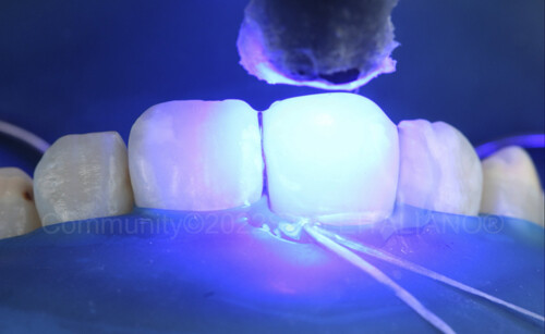 
		
		<p>
		Рис. 13</p>		