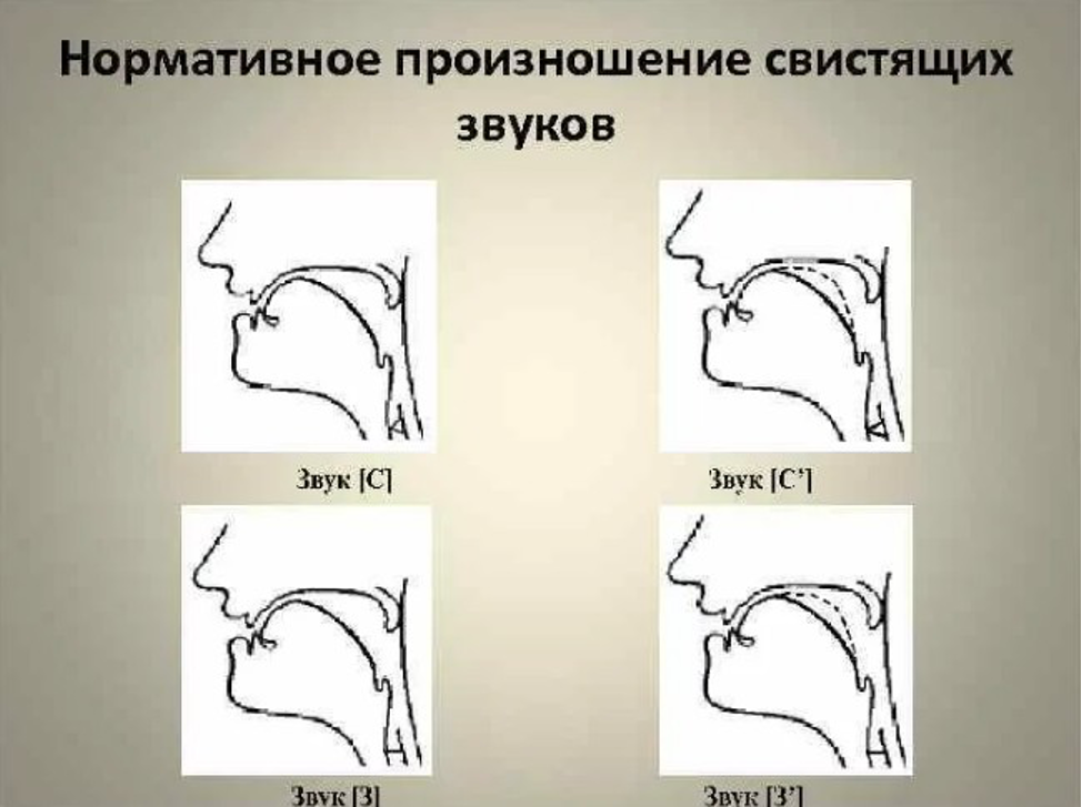 Постановка звука С в словах, слогах и словосочетаниях