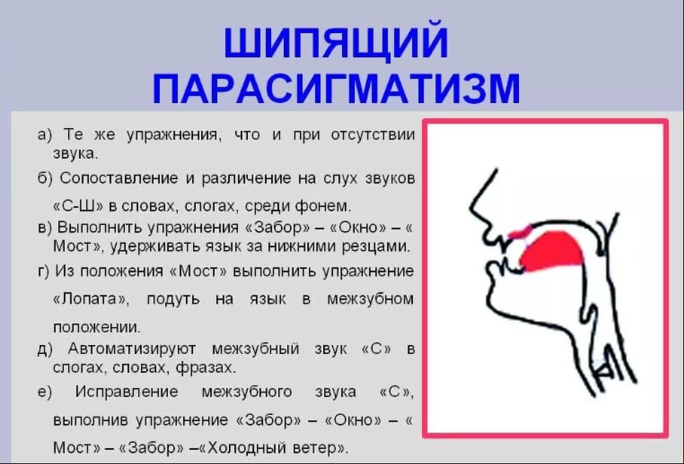 Сигматизм: причины, виды и методы коррекции | Дефектология Проф