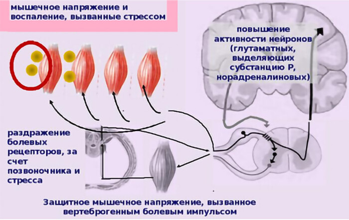 Картинки БОЛЯТ МЫШЦЫ ШЕИ И ПЛЕЧЕЙ