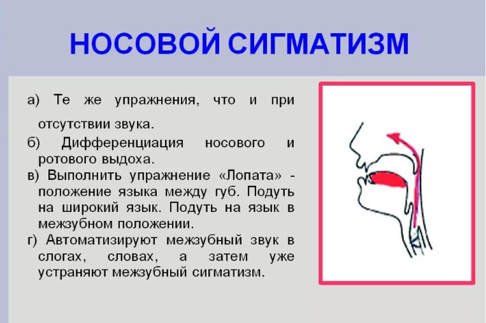 Сигматизм шипящих Сигматизм шипящих