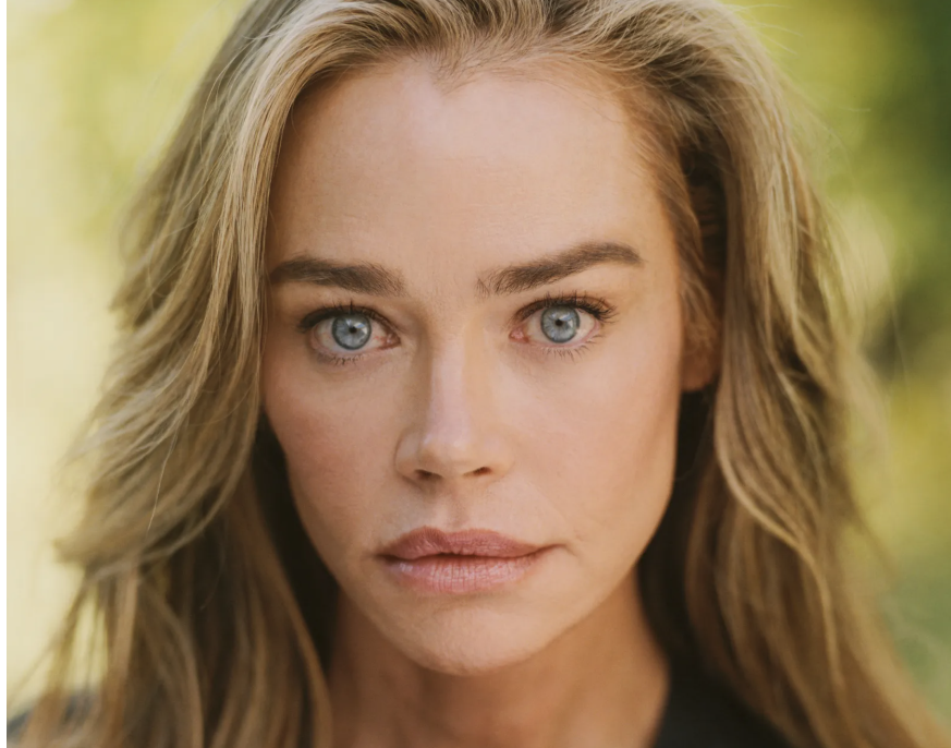 <p>
		Фейслифт актрисы Дениз Ричардс.	</p>